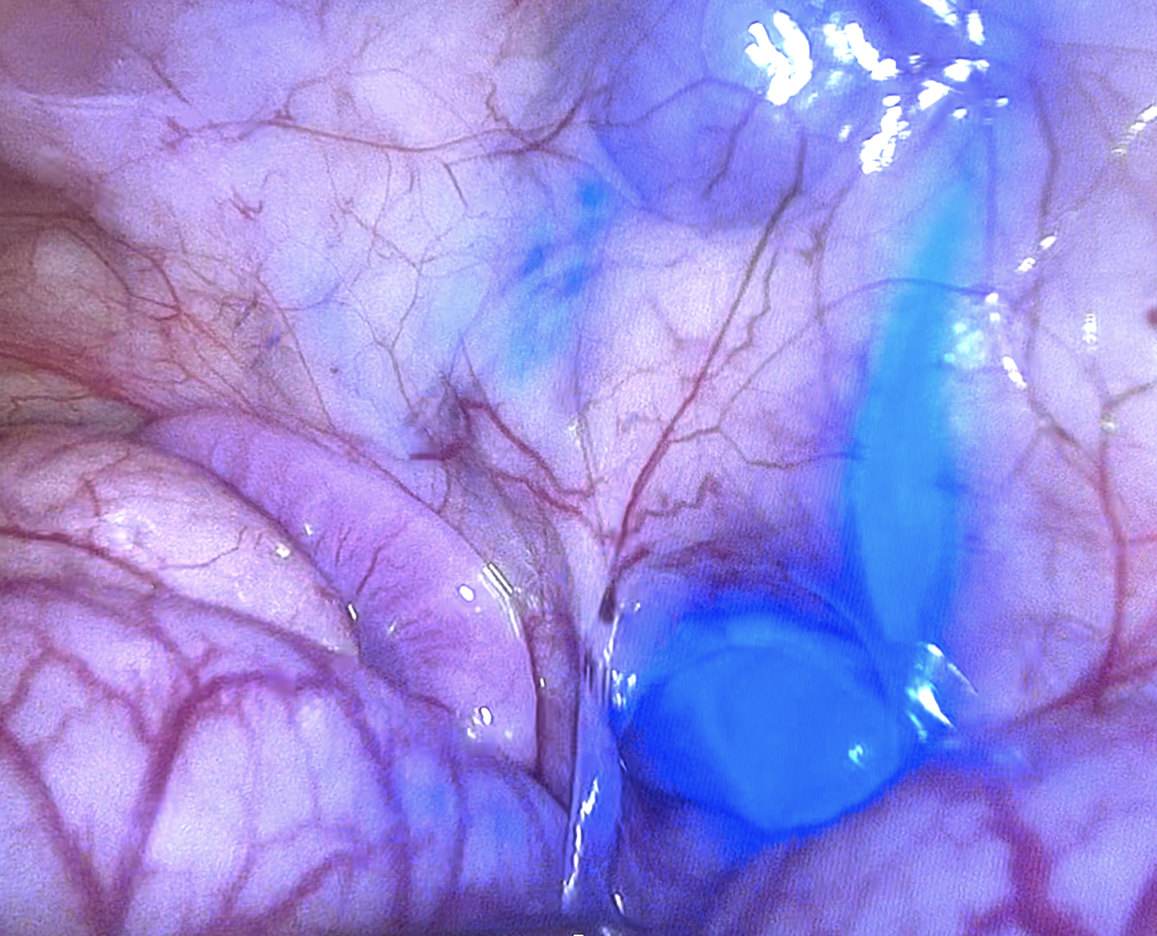 Image portrait